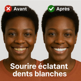 SP-6 Lot de 2 dentifrices super probiotique ultra blanchissants.