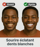 SP-6 Lot de 2 dentifrices super probiotique ultra blanchissants.