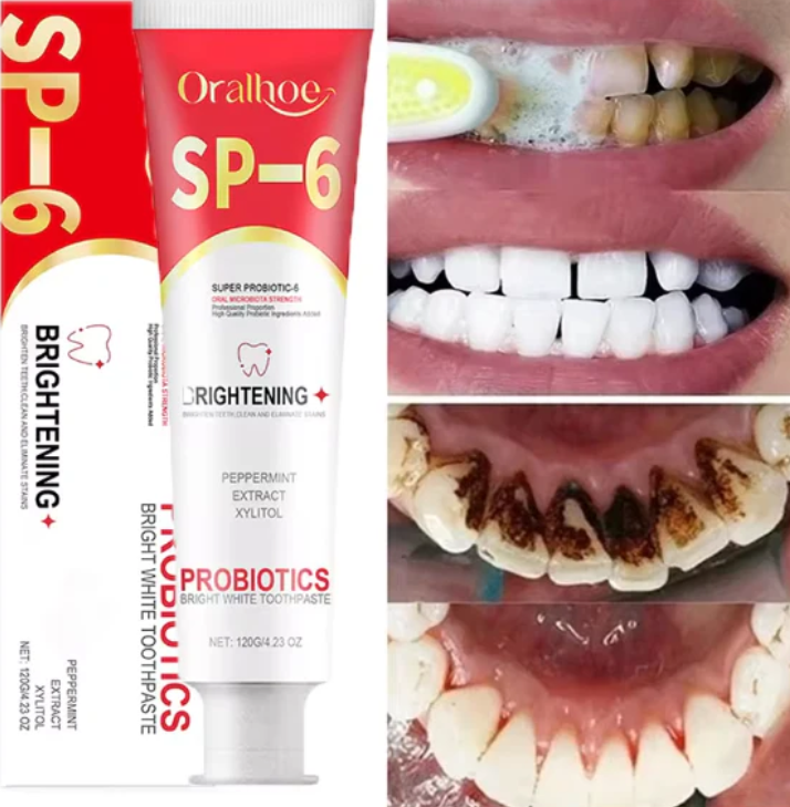 SP-6 Lot de 2 dentifrices super probiotique ultra blanchissants.