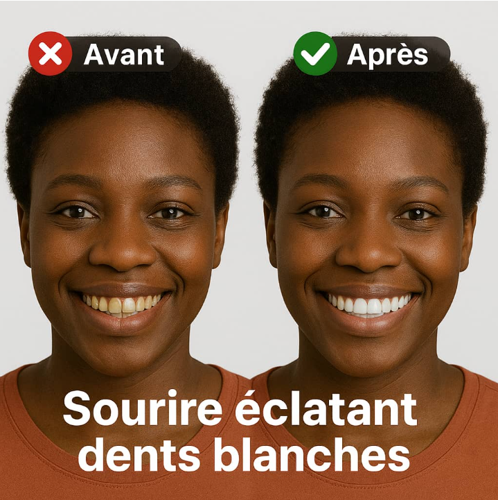 SP-6 Lot de 2 dentifrices super probiotique ultra blanchissants.