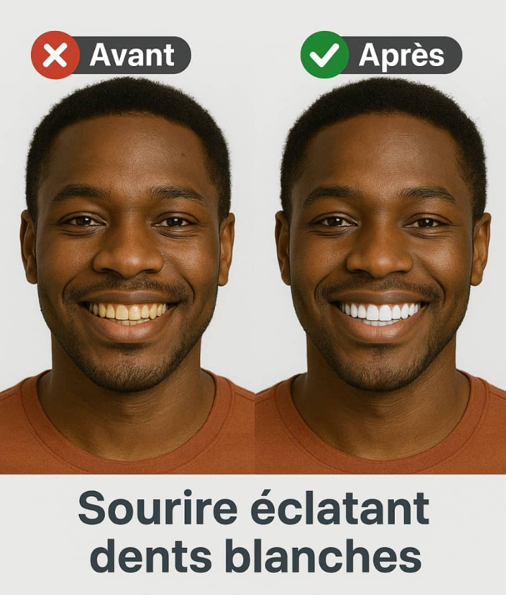 SP-6 Lot de 2 dentifrices super probiotique ultra blanchissants.